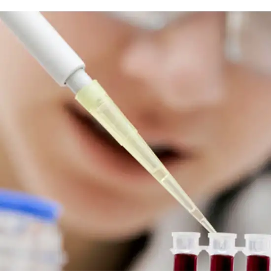 Human Immunodeficiency Virus (HIV) Rapid Screening Test